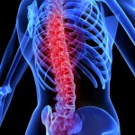 Rear-End Car Accidents and Neck & Back Injury